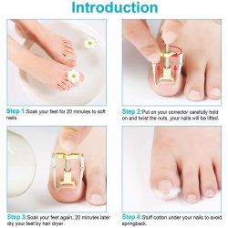 دستگاه اصلاح فرم و ارتودنسی ناخن مدل Nails